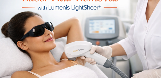 Laser hair removal treatment using Lumenis LightSheer diode technology in a Denver medical clinic